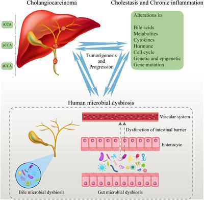 Dysbiosis in the Human Microbiome of Cholangiocarcinoma